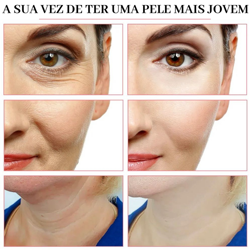 Estimulador Lifting Face Pro Max - 5 EM 1